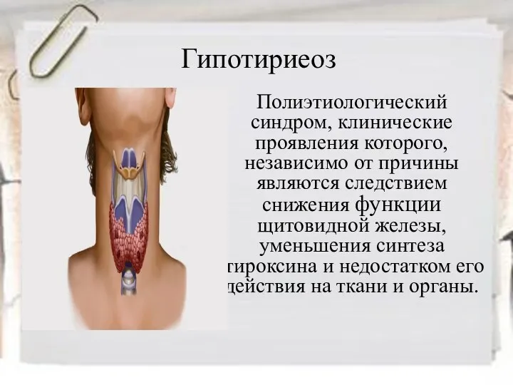 Гипотириеоз Полиэтиологический синдром, клинические проявления которого, независимо от причины являются