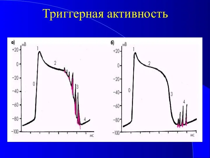 Триггерная активность