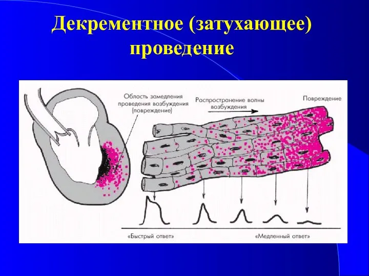 Декрементное (затухающее) проведение