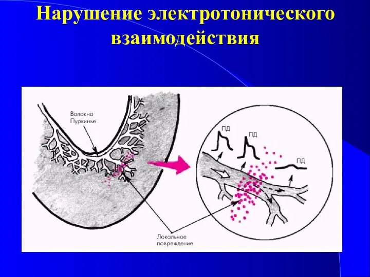 Нарушение электротонического взаимодействия