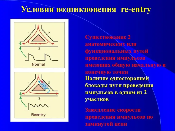 Условия возникновения re-entry Существование 2 анатомических или функциональных путей проведения