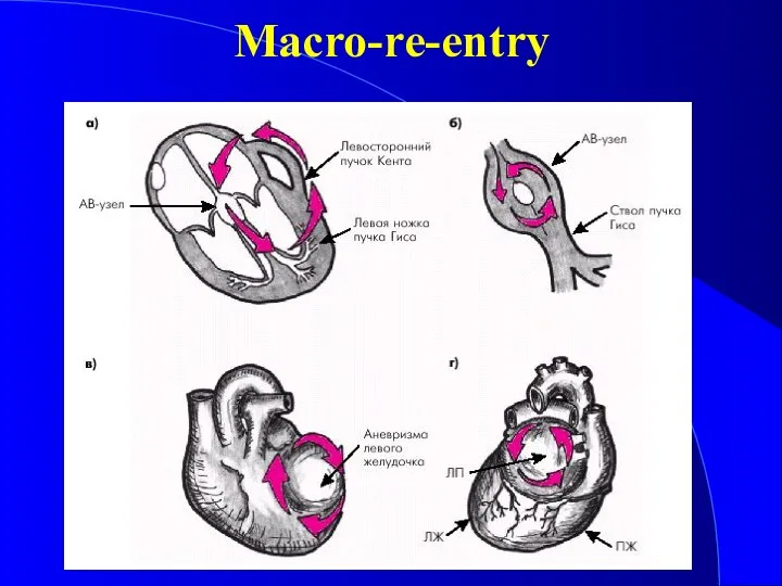 Macro-re-entry