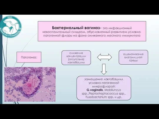 снижение концентрации (отсутствие) лактобацилл ощелачивание влагалищной среды замещение лактобацилл условно-патогенной