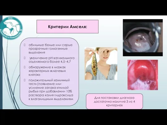 Критерии Амселя: Для постановки диагноза достаточно наличие 3 из 4