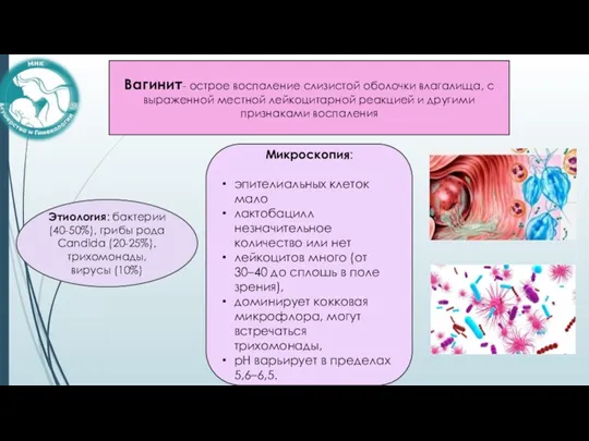 Вагинит- острое воспаление слизистой оболочки влагалища, с выраженной местной лейкоцитарной