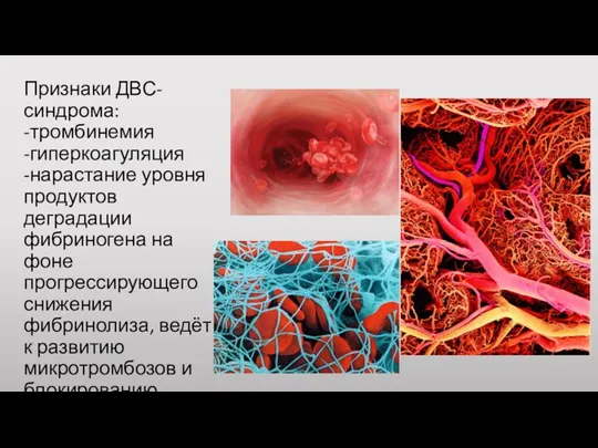 Признаки ДВС-синдрома: -тромбинемия -гиперкоагуляция -нарастание уровня продуктов деградации фибриногена на