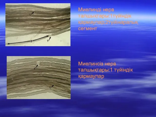 Миелинді нерв талшықтары:1түйіндік қармаулар;2түйінаралық сегмент Миелинсіз нерв талшықтары:1 түйіндік қармаулар
