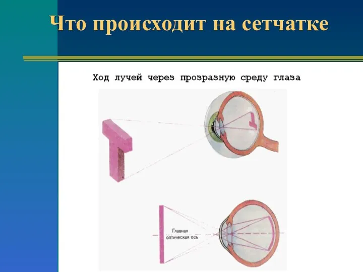 Что происходит на сетчатке