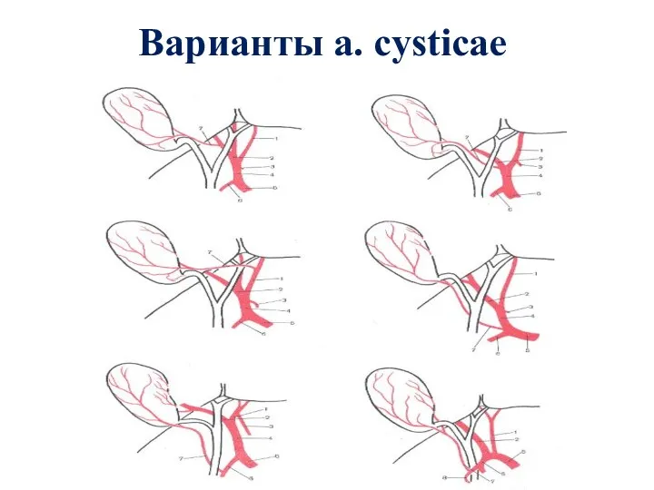Варианты а. cysticae
