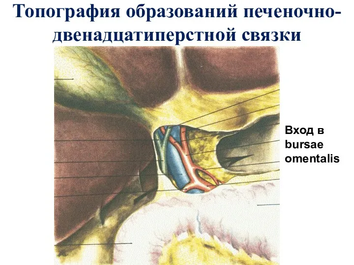 Топография образований печеночно-двенадцатиперстной связки Вход в bursae omentalis