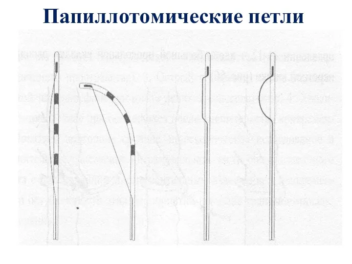 Папиллотомические петли