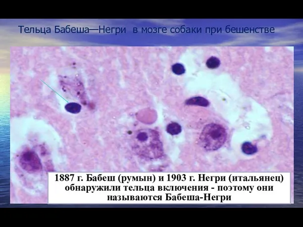 Тельца Бабеша—Негри в мозге собаки при бешенстве 1887 г. Бабеш