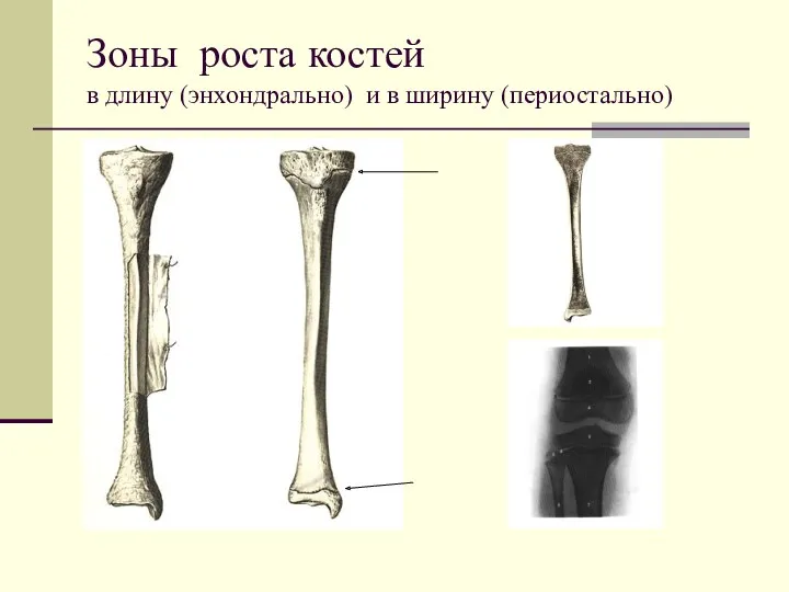 Зоны роста костей в длину (энхондрально) и в ширину (периостально)