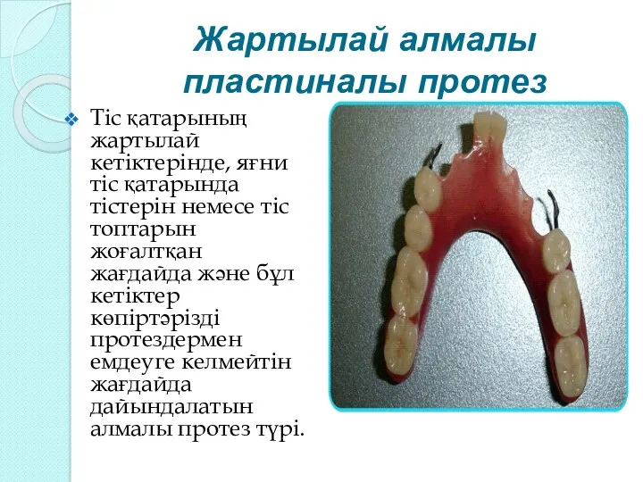 Жартылай алмалы пластиналы протез Тіс қатарының жартылай кетіктерінде, яғни тіс