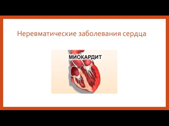 Неревматические заболевания сердца