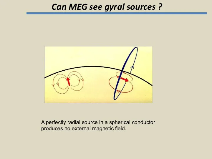 Can MEG see gyral sources ? A perfectly radial source