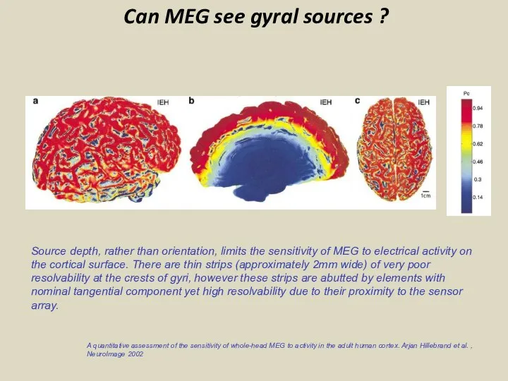 A quantitative assessment of the sensitivity of whole-head MEG to