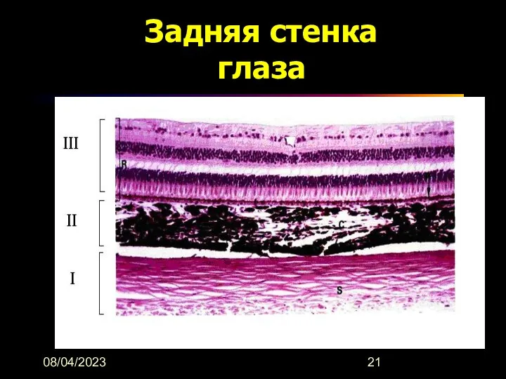 08/04/2023 Задняя стенка глаза