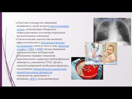 «Золотым стандартом» выявления пневмонии у детей остается рентгенография легких, позволяющая