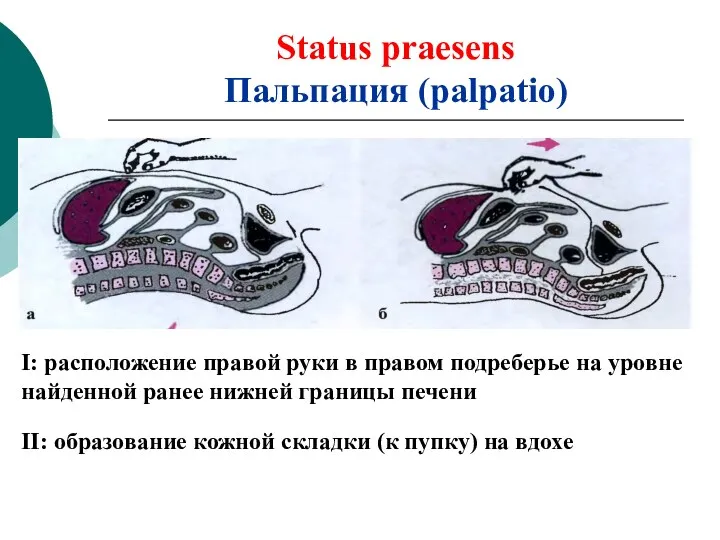 Status praesens Пальпация (palpatio) I: расположение правой руки в правом