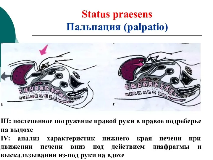 Status praesens Пальпация (palpatio) III: постепенное погружение правой руки в правое подреберье на