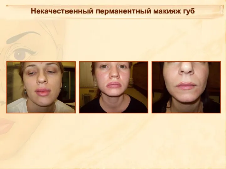 Некачественный перманентный макияж губ
