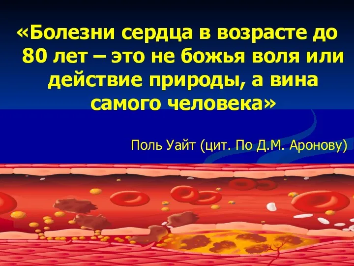 «Болезни сердца в возрасте до 80 лет – это не