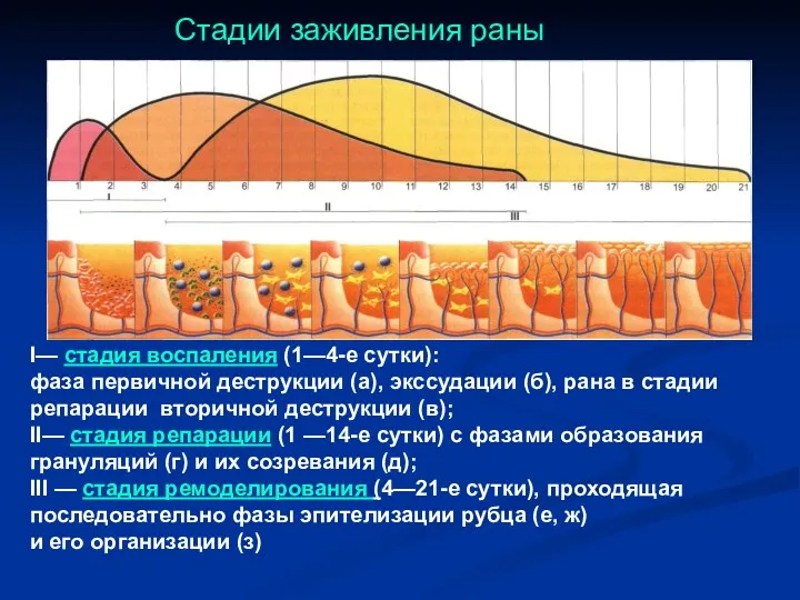 I— стадия воспаления (1—4-е сутки): фаза первичной деструкции (а), экссудации