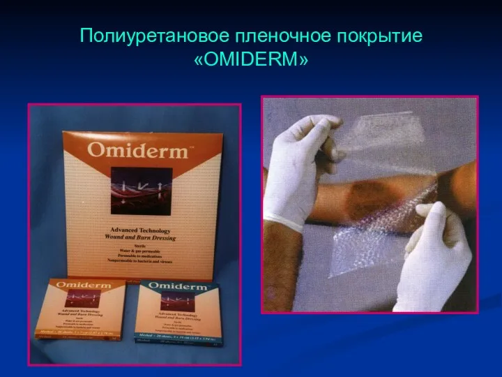 Полиуретановое пленочное покрытие «OMIDERM»