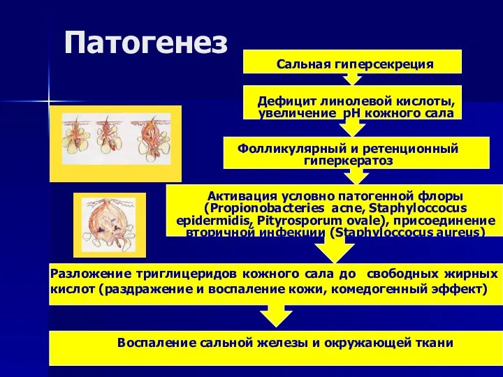 Патогенез Дефицит линолевой кислоты, увеличение рН кожного сала Фолликулярный и ретенционный гиперкератоз Активация