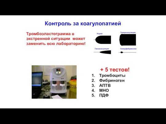 Контроль за коагулопатией Тромбоэластограмма в экстренной ситуации может заменить всю