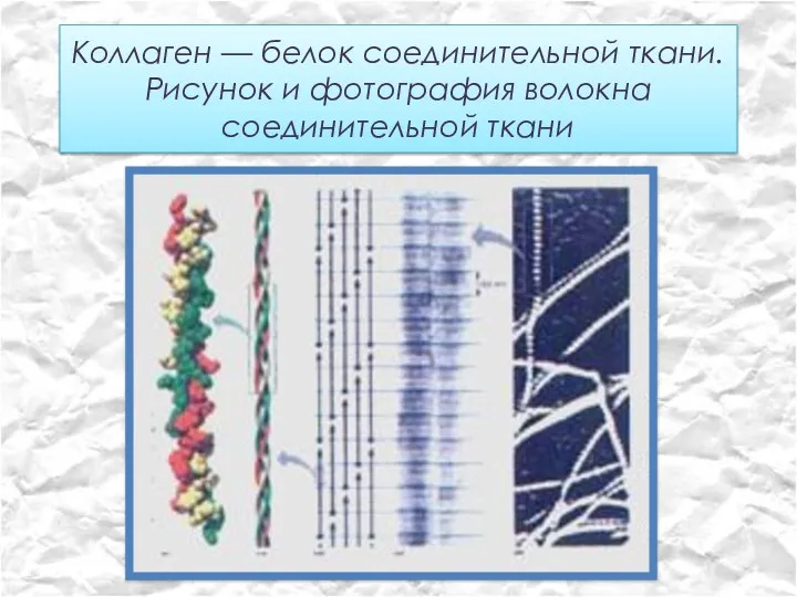 Коллаген — белок соединительной ткани. Рисунок и фотография волокна соединительной ткани