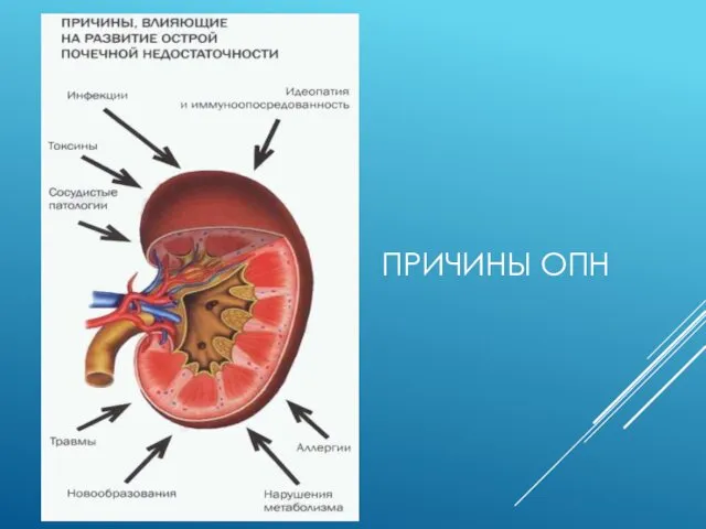 ПРИЧИНЫ ОПН