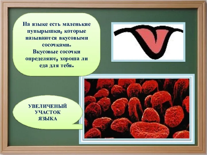 УВЕЛИЧЕНЫЙ УЧАСТОК ЯЗЫКА На языке есть маленькие пупырышки, которые называются