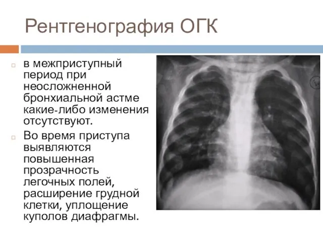 Рентгенография ОГК в межприступный период при неосложненной бронхиальной астме какие-либо
