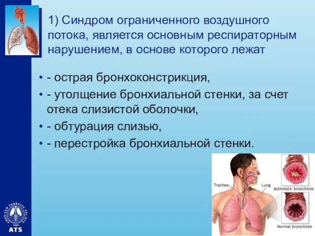 1) Синдром ограниченного воздушного потока, является основным респираторным нарушением, в