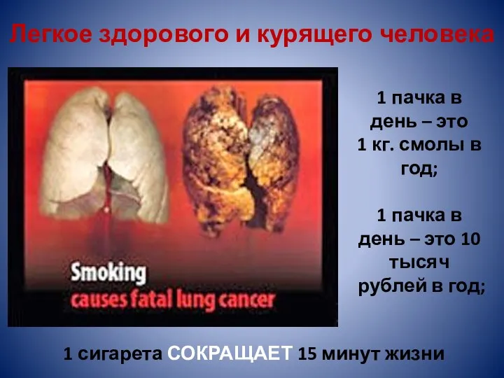 Легкое здорового и курящего человека 1 сигарета СОКРАЩАЕТ 15 минут жизни 1 пачка