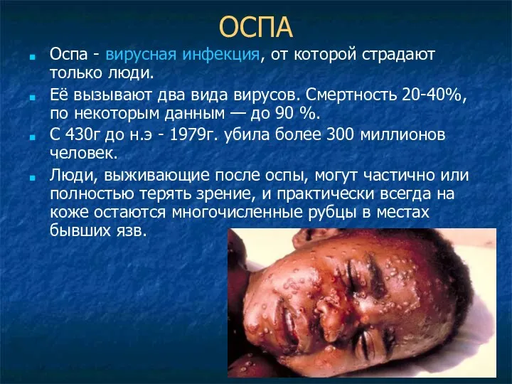 ОСПА Оспа - вирусная инфекция, от которой страдают только люди.