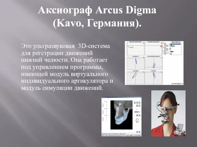 Аксиограф Arcus Digma (Kavo, Германия). Это ультразвуковая 3D-система для регстрации