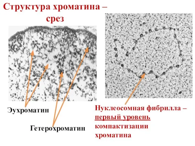 Структура хроматина – срез Нуклеосомная фибрилла – первый уровень компактизации хроматина Эухроматин Гетерохроматин