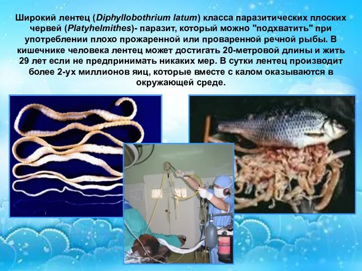 Широкий лентец (Diphyllobothrium latum) класса паразитических плоских червей (Platyhelmithes)- паразит,