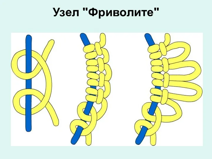 Узел "Фриволите"