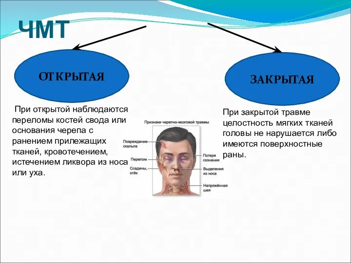 ЧМТ ЗАКРЫТАЯ ОТКРЫТАЯ При закрытой травме целостность мягких тканей головы