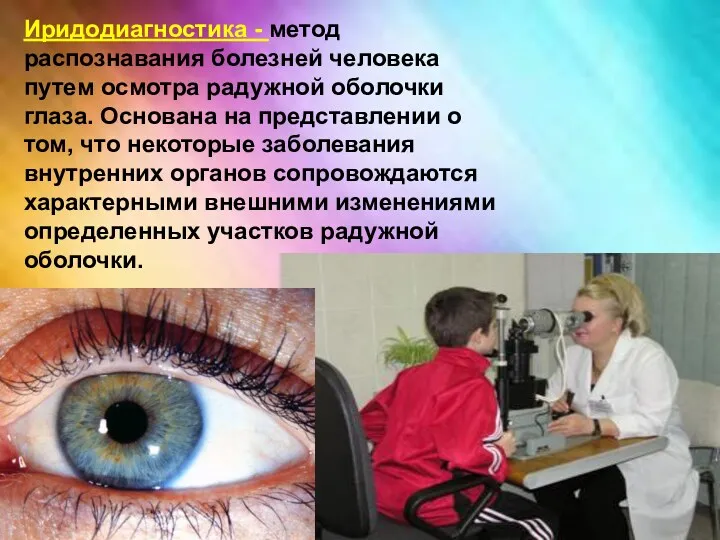 Иридодиагностика - метод распознавания болезней человека путем осмотра радужной оболочки глаза. Основана на