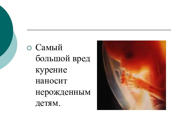 Самый большой вред курение наносит нерожденным детям.