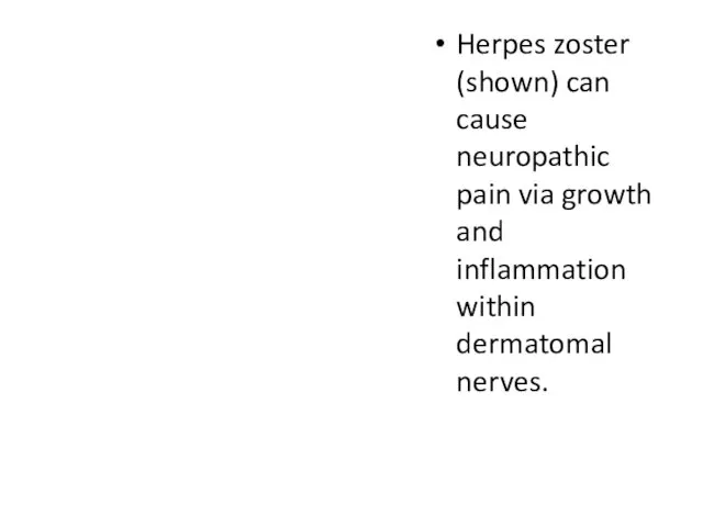 Herpes zoster (shown) can cause neuropathic pain via growth and inflammation within dermatomal nerves.