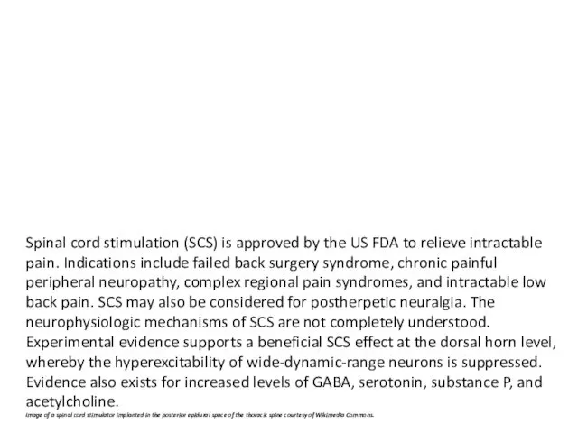 Spinal cord stimulation (SCS) is approved by the US FDA