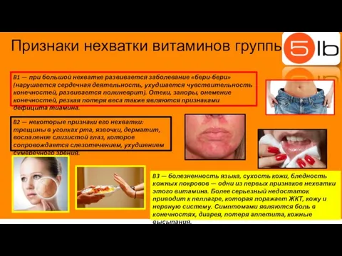 Признаки нехватки витаминов группы В B1 — при большой нехватке