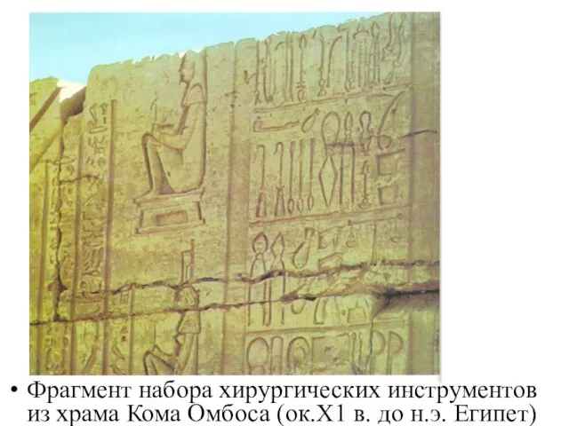 Фрагмент набора хирургических инструментов из храма Кома Омбоса (ок.Х1 в. до н.э. Египет)