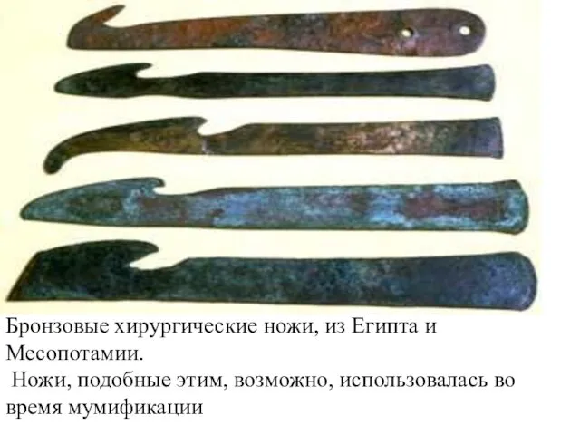 Бронзовый хирургических ножей, из Египта и Месопотамии, c.600-200BC. Ножи, подобные этим, возможно, использовалась